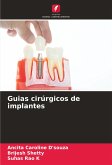 Guias cirúrgicos de implantes