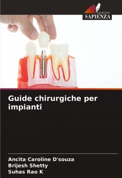 Guide chirurgiche per impianti - D'souza, Ancita Caroline;Shetty, Brijesh;K, Suhas Rao