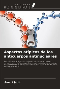 Aspectos atípicos de los anticuerpos antinucleares - Jerbi, Ameni