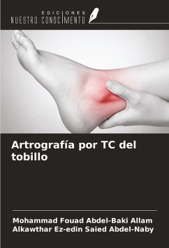 Artrografía por TC del tobillo - Allam, Mohammad Fouad Abdel-Baki; Abdel-Naby, Alkawthar Ez-Edin Saied Artrografía por TC del tobillo - Allam, Mohammad Fouad Abdel-Baki; Abdel-Naby, Alkawthar Ez-Edin Saied