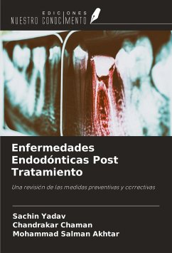 Enfermedades Endodónticas Post Tratamiento - Yadav, Sachin; Chaman, Chandrakar; Akhtar, Mohammad Salman