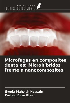 Cover Microfugas en composites dentales: Microhíbridos frente a nanocomposites