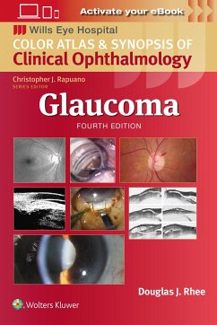 Glaucoma - Rhee, Douglas J.