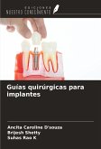 Guías quirúrgicas para implantes