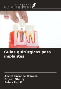 Guías quirúrgicas para implantes - D'souza, Ancita Caroline; Shetty, Brijesh; K, Suhas Rao