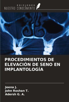Cover PROCEDIMIENTOS DE ELEVACIÓN DE SENO EN IMPLANTOLOGÍA