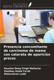 Presencia concomitante de carcinoma de mama con catarata de aparición precoz