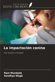 La impactación canina