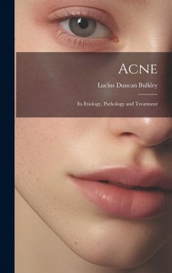 Cover Acne