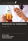 Ampliación en endodoncia