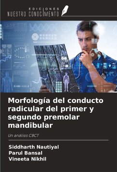 Morfología del conducto radicular del primer y segundo premolar mandibular - Nautiyal, Siddharth; Bansal, Parul; Nikhil, Vineeta