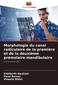 Morphologie du canal radiculaire de la première et de la deuxième prémolaire mandibulaire - Nautiyal, Siddharth;Bansal, Parul;Nikhil, Vineeta