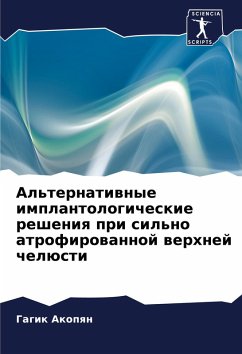 Cover Al'ternatiwnye implantologicheskie resheniq pri sil'no atrofirowannoj werhnej chelüsti