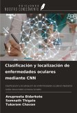 Clasificación y localización de enfermedades oculares mediante CNN