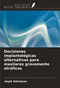 Decisiones implantológicas alternativas para maxilares gravemente atróficos - Hakobyan, Gagik