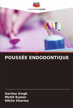 POUSSÉE ENDODONTIQUE - Singh, Garima;Kumar, Mohit;Sharma, Nikita