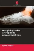 Imagiologia das artropatias microcristalinas