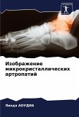 Izobrazhenie mikrokristallicheskih artropatij Izobrazhenie mikrokristallicheskih artropatij