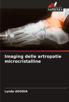 Imaging delle artropatie microcristalline - Aoudia, Lynda