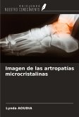 Imagen de las artropatías microcristalinas