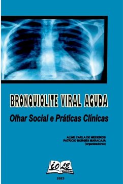 Bronquiolite Viral Aguda - Aline, Medeiros