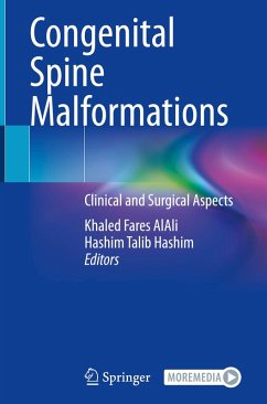 Cover Congenital Spine Malformations