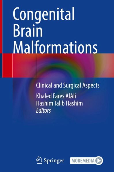 Congenital Brain Malformations Congenital Brain Malformations