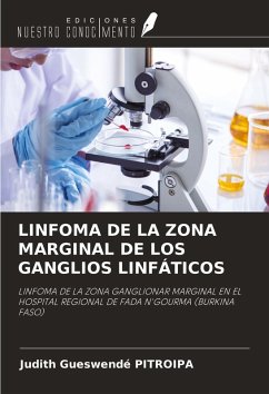 Cover LINFOMA DE LA ZONA MARGINAL DE LOS GANGLIOS LINFÁTICOS