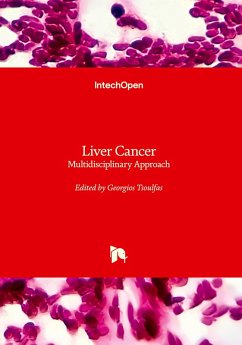Cover Liver Cancer - Multidisciplinary Approach