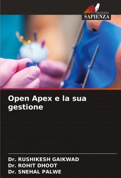 Open Apex e la sua gestione - GAIKWAD, Dr. RUSHIKESH;Dhoot, Dr. Rohit;Palwe, Dr. Snehal