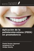 Aplicación de la polieteretercetona (PEEK) en prostodoncia