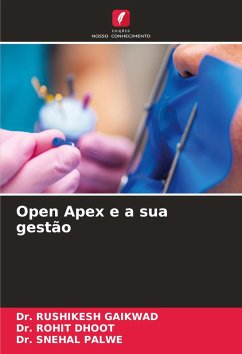 Open Apex e a sua gestão - GAIKWAD, Dr. RUSHIKESH;Dhoot, Dr. Rohit;Palwe, Dr. Snehal