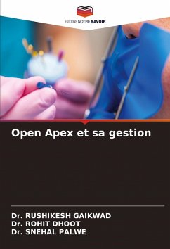 Cover Open Apex et sa gestion