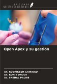 Open Apex y su gestión