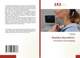 Nodules thyroïdiens Nodules thyroïdiens