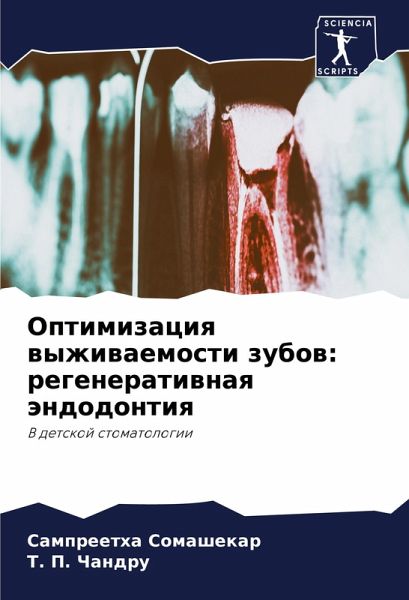 Optimizaciq wyzhiwaemosti zubow: regeneratiwnaq ändodontiq Optimizaciq wyzhiwaemosti zubow: regeneratiwnaq ändodontiq