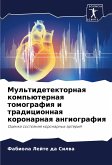 Mul'tidetektornaq komp'üternaq tomografiq i tradicionnaq koronarnaq angiografiq