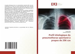 Cover Profil étiologique du pneumothorax spontané à propos de 206 cas