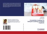 Immediate Loading V/s Delayed Loading of Dental Implants Immediate Loading V/s Delayed Loading of Dental Implants