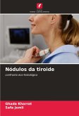 Nódulos da tiroide Nódulos da tiroide