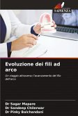 Evoluzione dei fili ad arco Evoluzione dei fili ad arco