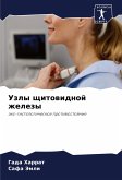 Uzly schitowidnoj zhelezy Uzly schitowidnoj zhelezy