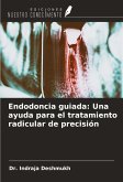 Endodoncia guiada: Una ayuda para el tratamiento radicular de precisión