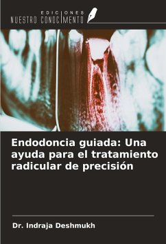 Endodoncia guiada: Una ayuda para el tratamiento radicular de precisión - Deshmukh, Indraja Endodoncia guiada: Una ayuda para el tratamiento radicular de precisión - Deshmukh, Indraja
