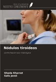 Nódulos tiroideos Nódulos tiroideos