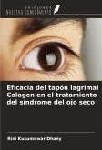 Eficacia del tapón lagrimal Colagen en el tratamiento del síndrome del ojo seco Eficacia del tapón lagrimal Colagen en el tratamiento del síndrome del ojo seco