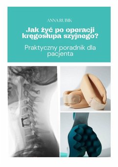 Cover Jak zyc po operacji kregoslupa szyjnego? (eBook, ePUB)