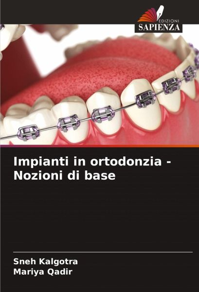 Impianti in ortodonzia - Nozioni di base Impianti in ortodonzia - Nozioni di base