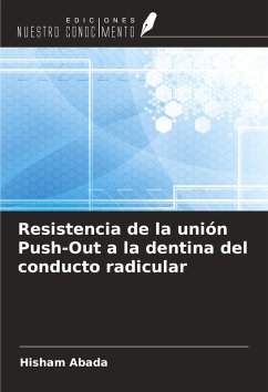 Resistencia de la unión Push-Out a la dentina del conducto radicular - Abada, Hisham