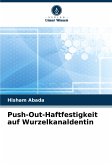 Push-Out-Haftfestigkeit auf Wurzelkanaldentin